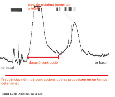 Gràfica d'una contracció