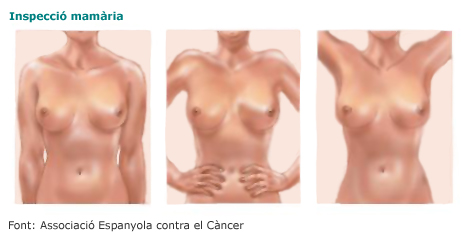 Tres imatges amb diferents postures bra&ccedil;os abaix, mans en la cintura, bra&ccedil;os cap amunt