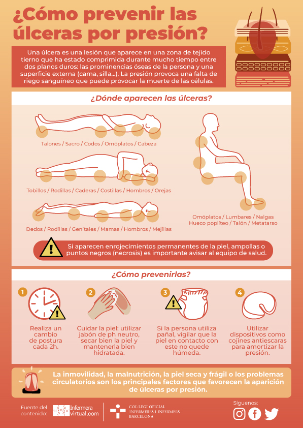 Infografía úlceras por presión