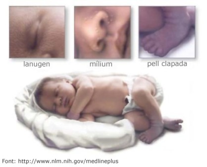 Posibilidad de piel en el recién nacido. Fuente: https://www.nlm.nih.gov/medlineplus/