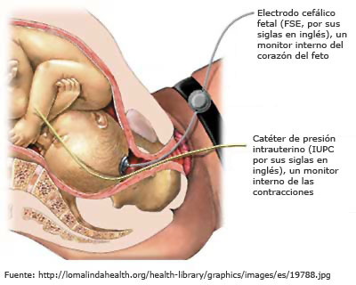 Qué es el latido fetal: el signo de confirmación que marca un antes y un  después para el embarazo