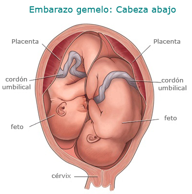 Embarazo de gemelos los dos cabeza abajo