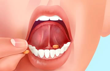 administración pastilla debajo de la lengua