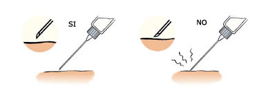 Forma correcta d'introduir l'agulla a la pell
